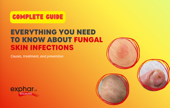 Fungal Infection - exphar nigeria